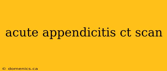 acute appendicitis ct scan