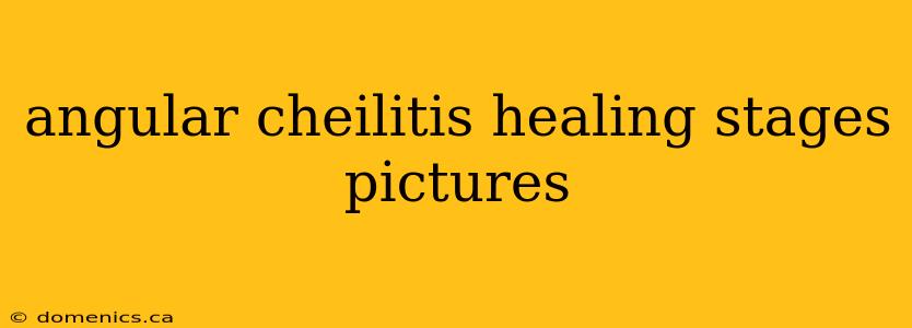 angular cheilitis healing stages pictures