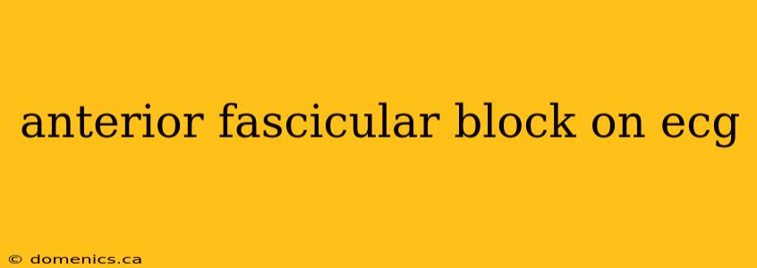 anterior fascicular block on ecg