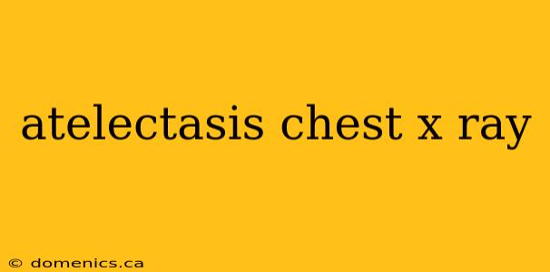 atelectasis chest x ray