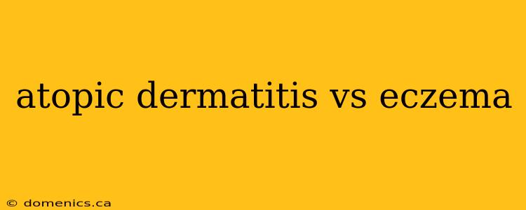 atopic dermatitis vs eczema