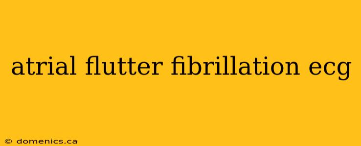 atrial flutter fibrillation ecg