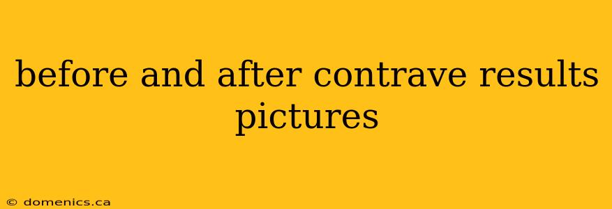 before and after contrave results pictures