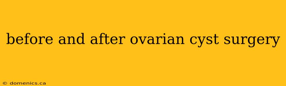 before and after ovarian cyst surgery