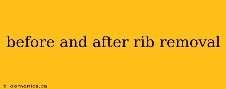 before and after rib removal