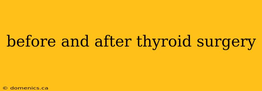 before and after thyroid surgery