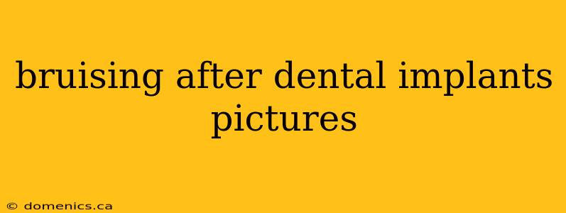 bruising after dental implants pictures