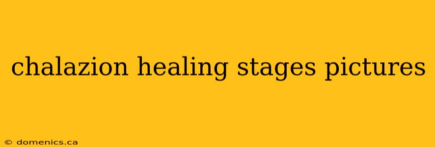 chalazion healing stages pictures