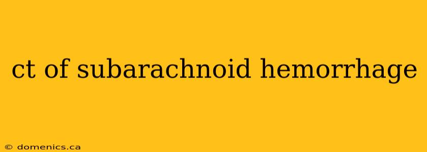 ct of subarachnoid hemorrhage