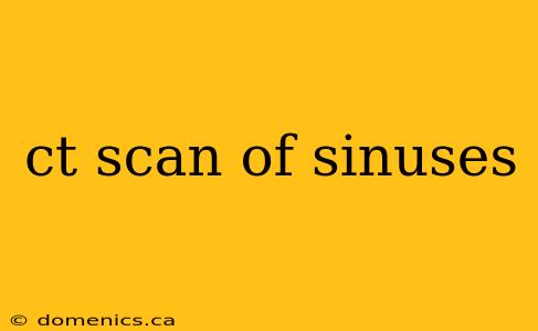 ct scan of sinuses