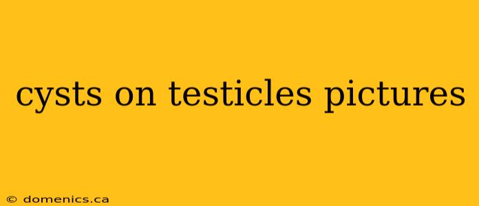 cysts on testicles pictures