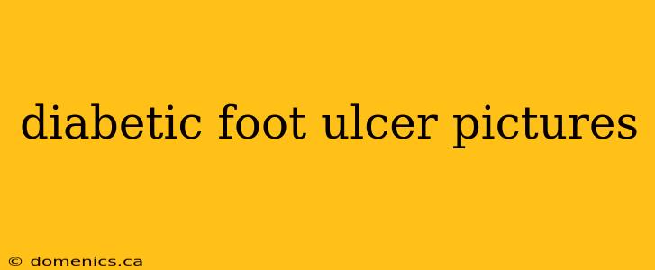 diabetic foot ulcer pictures