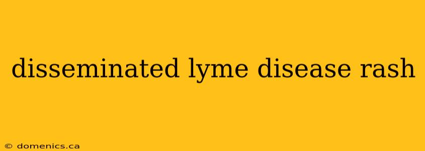 disseminated lyme disease rash