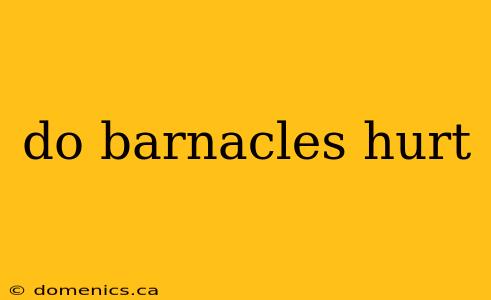 do barnacles hurt