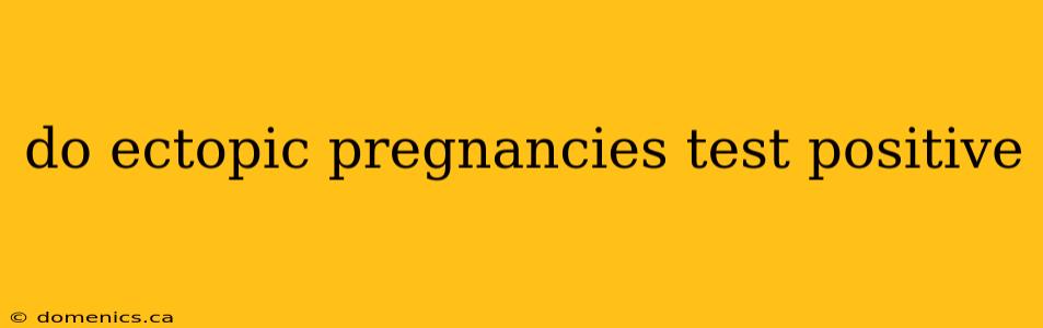 do ectopic pregnancies test positive
