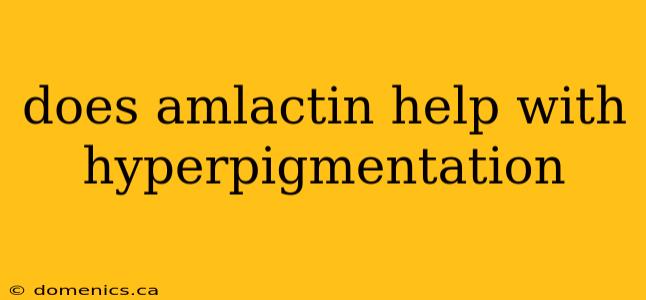 does amlactin help with hyperpigmentation