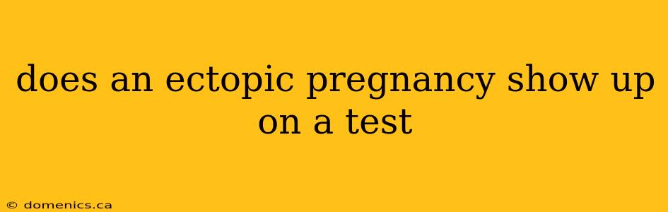 does an ectopic pregnancy show up on a test