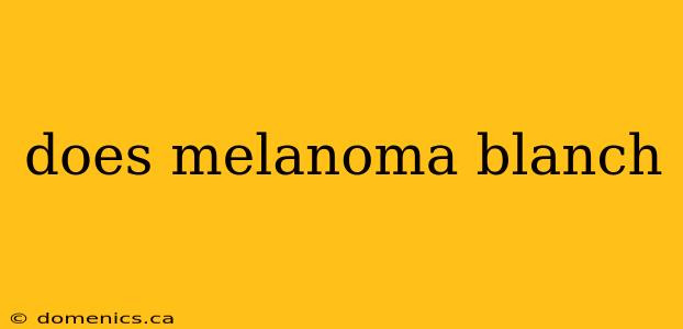 does melanoma blanch