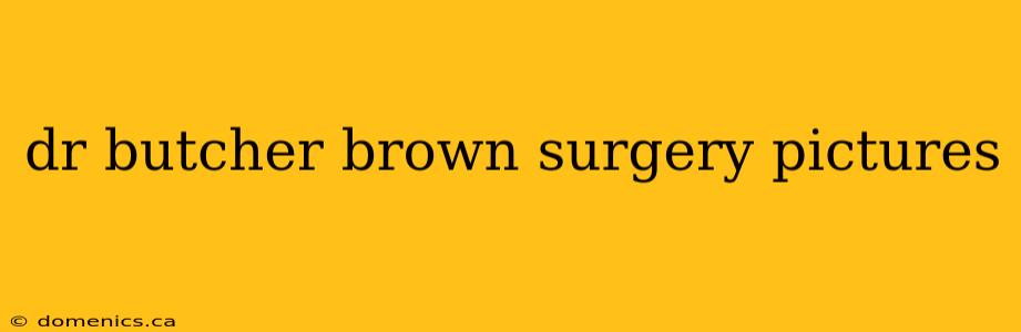 dr butcher brown surgery pictures