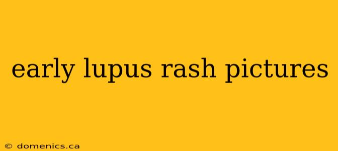 early lupus rash pictures