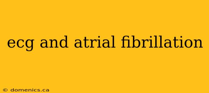 ecg and atrial fibrillation