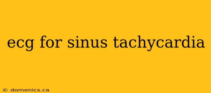 ecg for sinus tachycardia