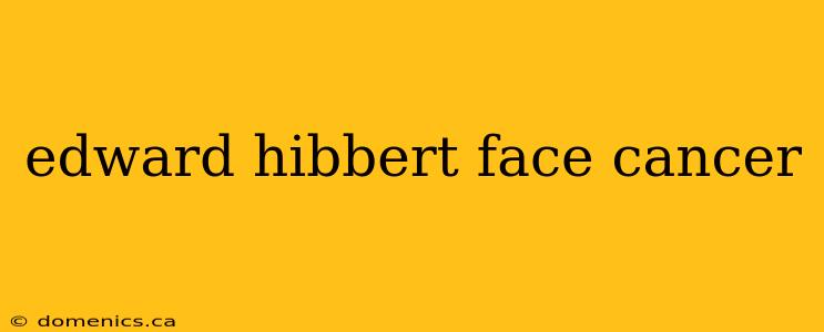 edward hibbert face cancer