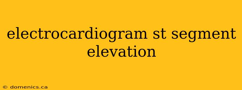 electrocardiogram st segment elevation