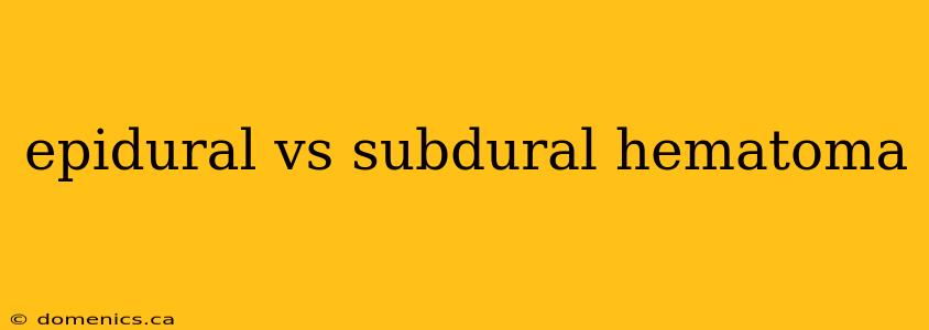 epidural vs subdural hematoma