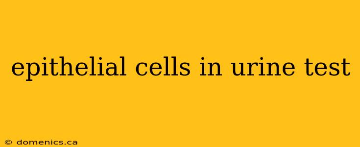 epithelial cells in urine test