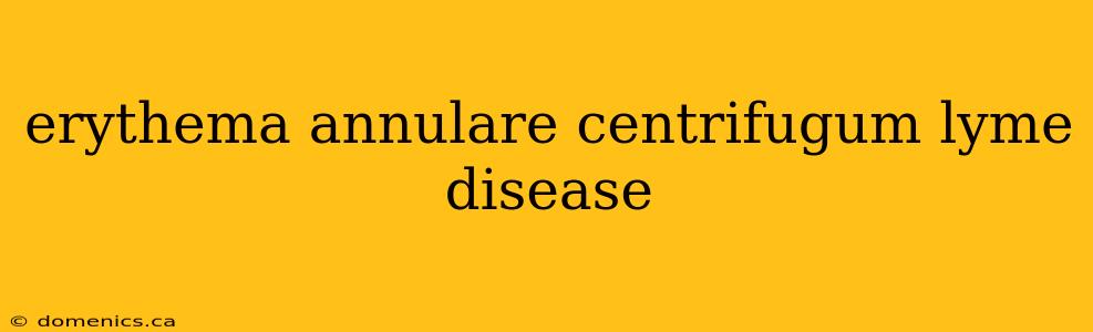 erythema annulare centrifugum lyme disease