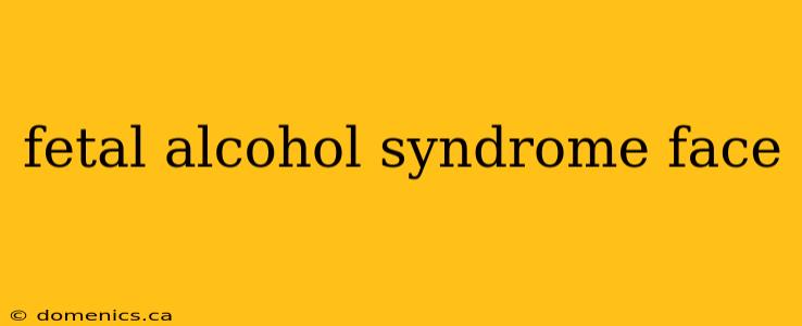 fetal alcohol syndrome face