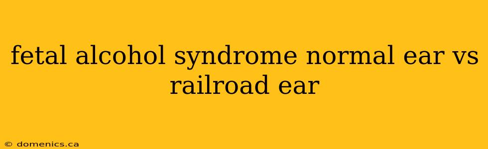 fetal alcohol syndrome normal ear vs railroad ear