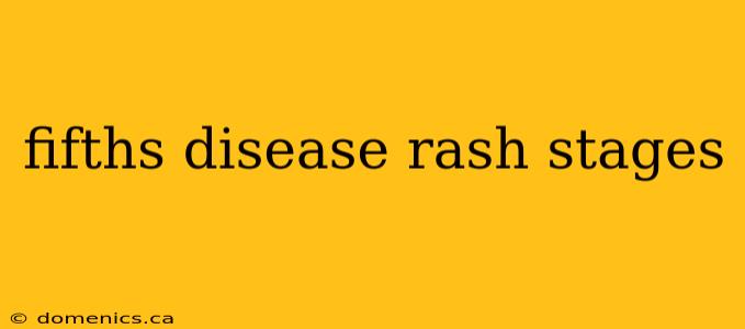 fifths disease rash stages