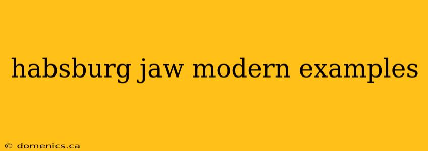 habsburg jaw modern examples