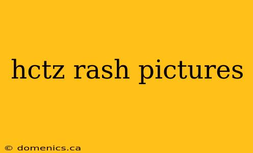 hctz rash pictures