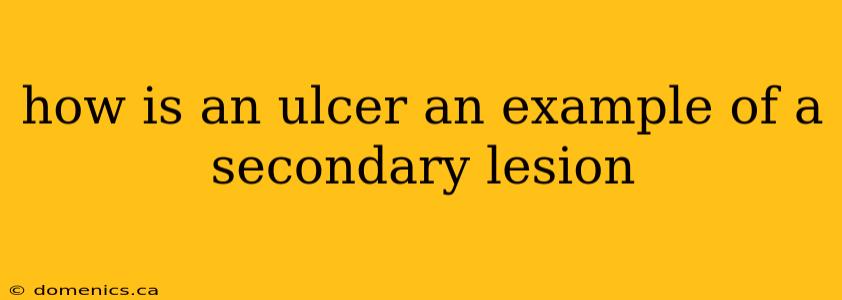 how is an ulcer an example of a secondary lesion