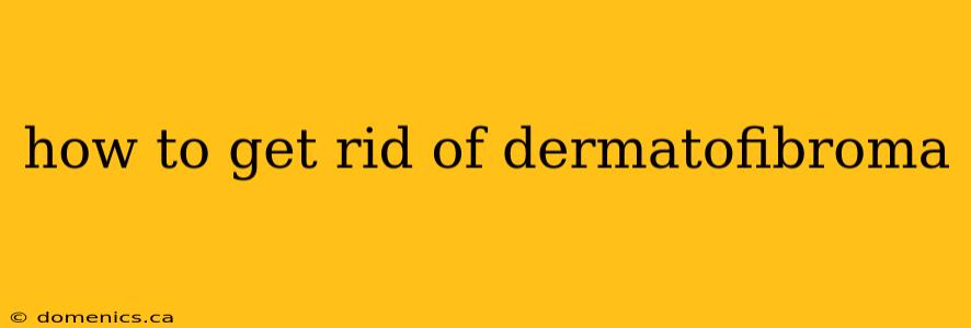 how to get rid of dermatofibroma