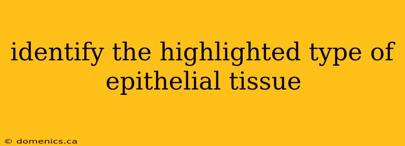 identify the highlighted type of epithelial tissue