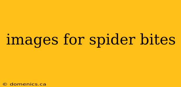 images for spider bites