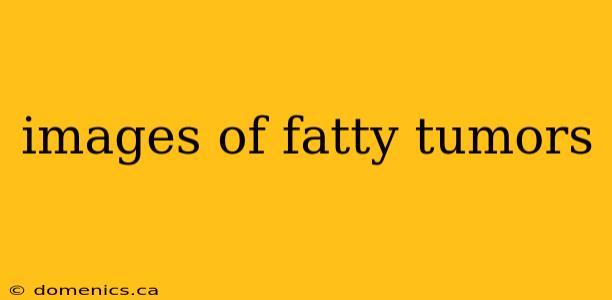 images of fatty tumors