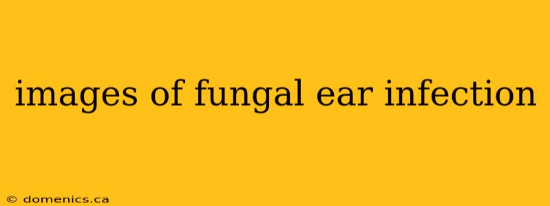 images of fungal ear infection