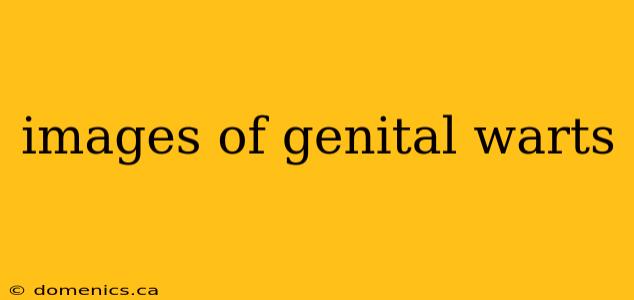 images of genital warts