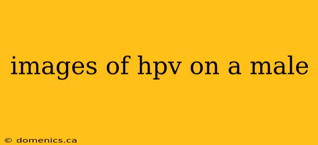 images of hpv on a male