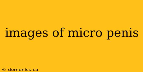 images of micro penis