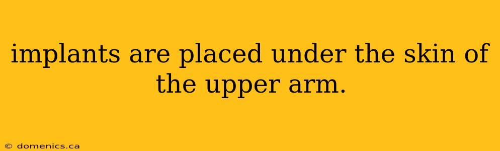 implants are placed under the skin of the upper arm.