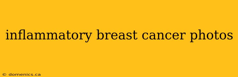 inflammatory breast cancer photos