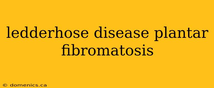 ledderhose disease plantar fibromatosis