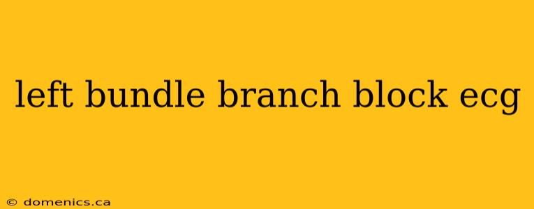 left bundle branch block ecg