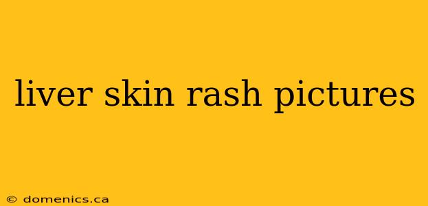 liver skin rash pictures